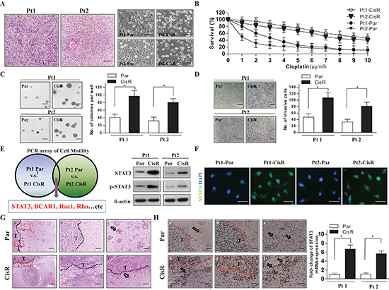 Cisplatin-selected resistant ATRT cells display a more malignant phenotype and increased expression of STAT3.