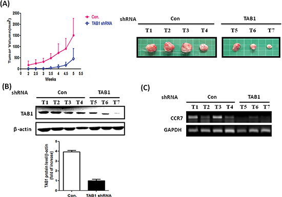 Reduction of in vivo tumor growth in TAB1-inhibited MDA-MB-231 cells.