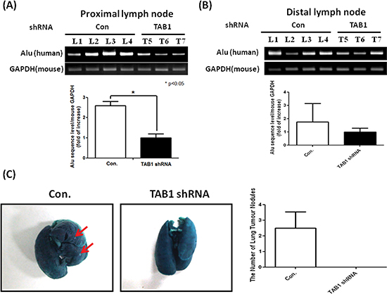 Inhibition of lymph node and lung metastasis by TAB1 knockdown.