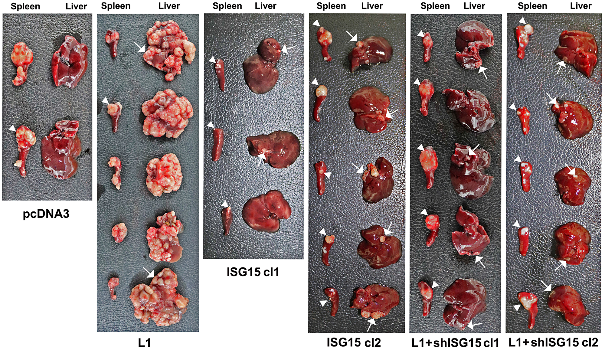 Overexpression of ISG15 enhances liver metastasis of CRC cells and ISG15 suppression in L1-overexpressing cells blocks metastasis.