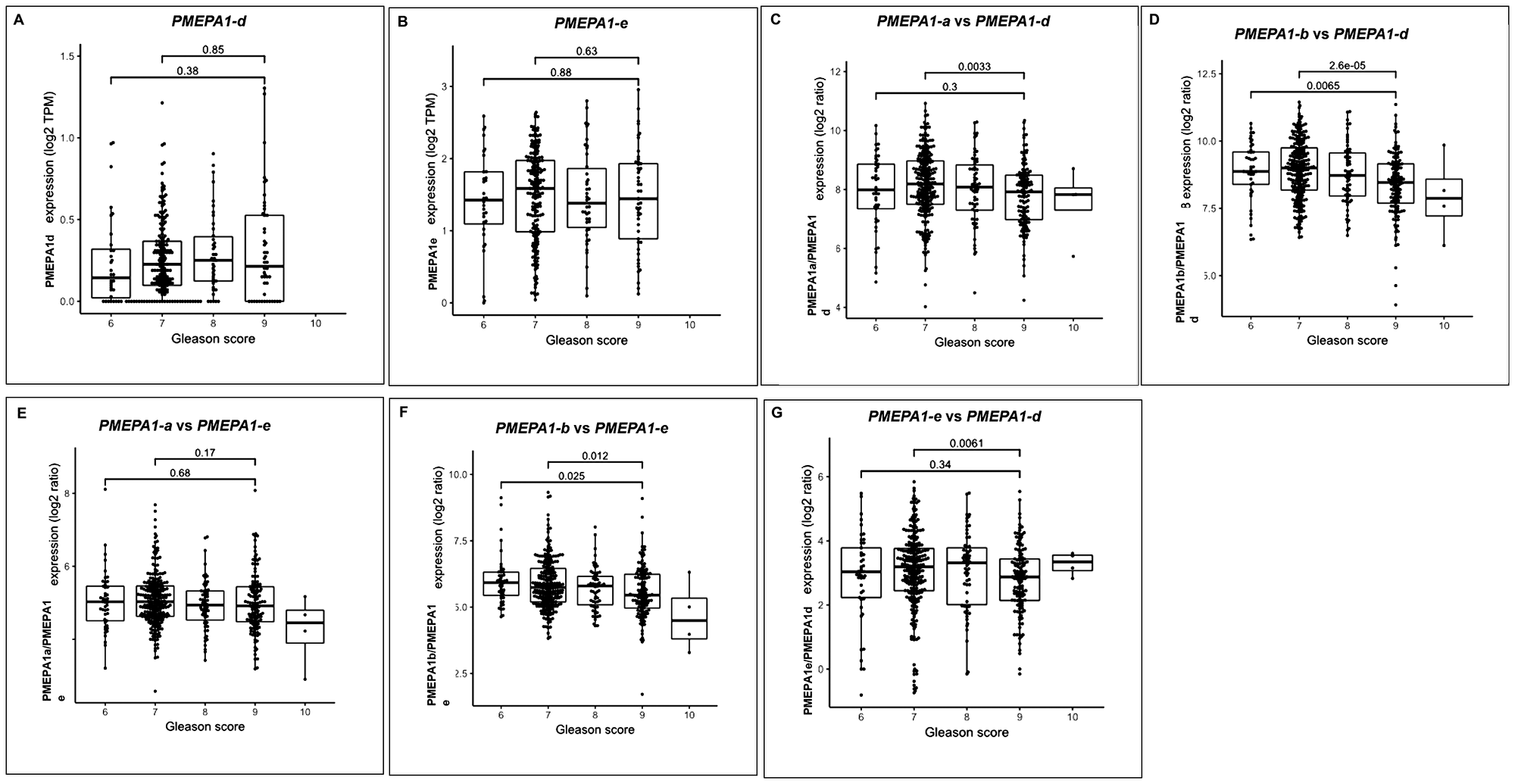 PMEPA1 isoforms (d and e) collectively associated with increased Gleason score of prostate cancer.