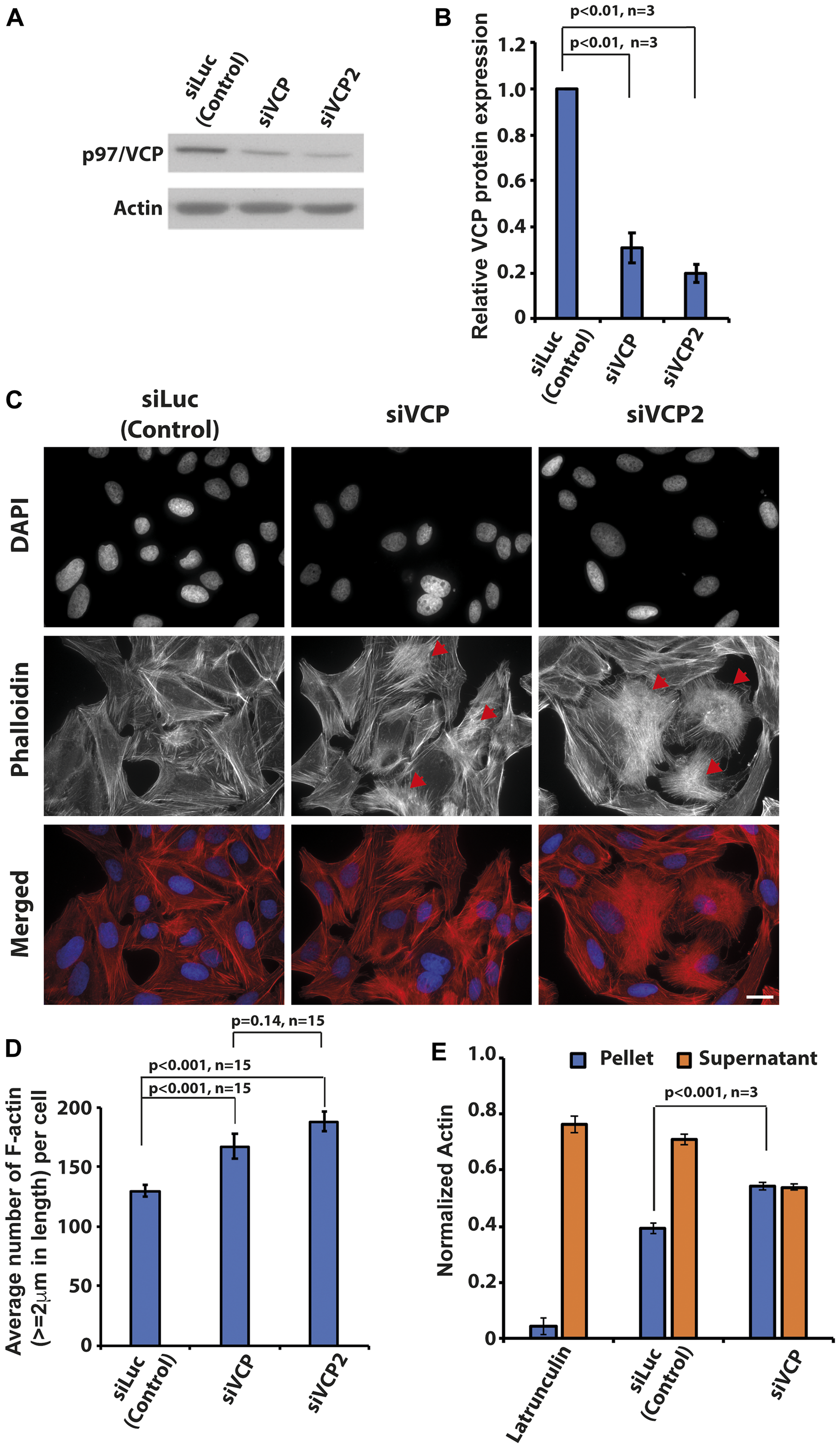 Knockdown of p97/VCP induced changes in actin morphology.