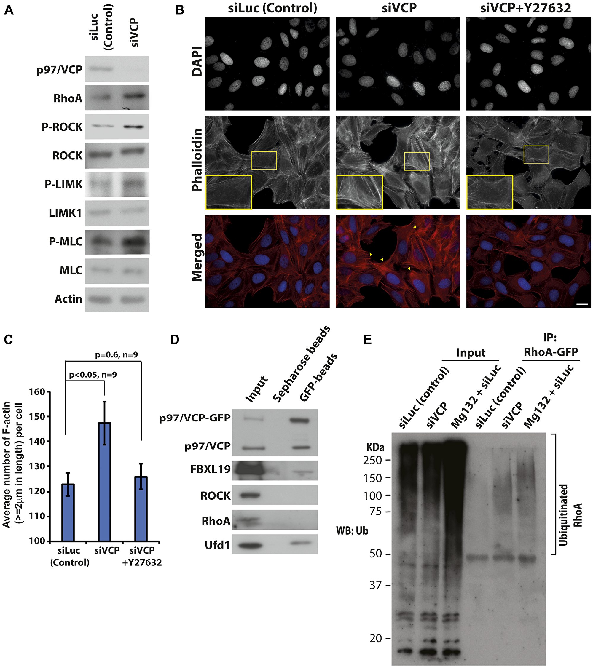 Loss of p97/VCP induces Rho-ROCK signaling pathway.