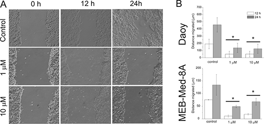GDC-0941 inhibits medulloblastoma cell migration.
