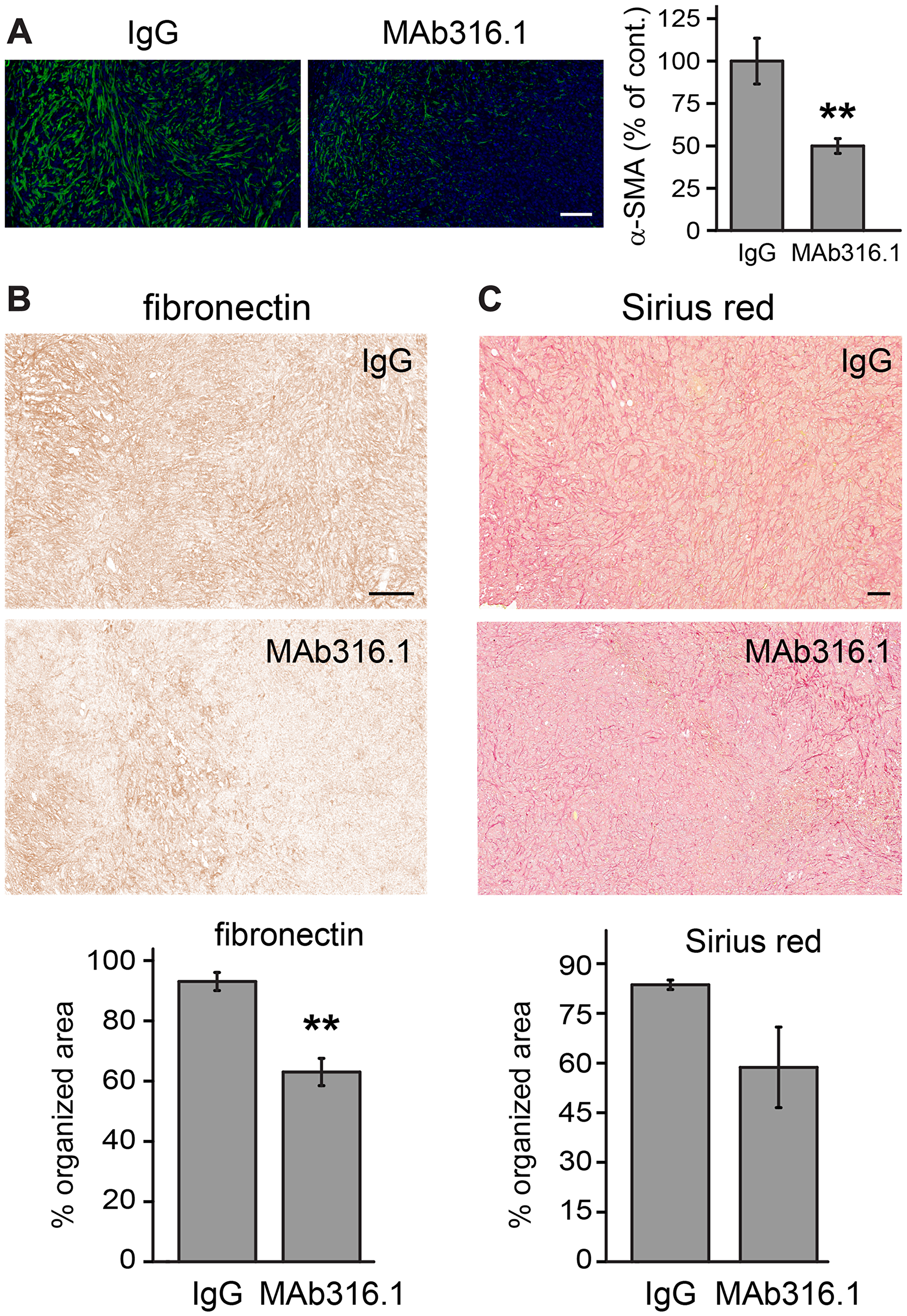 4T1 tumors from mice treated with MAb316.1 show decreased stromal participation.