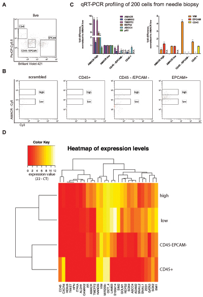 Cell type resolved analysis of human prostate cancer needle biopsy,