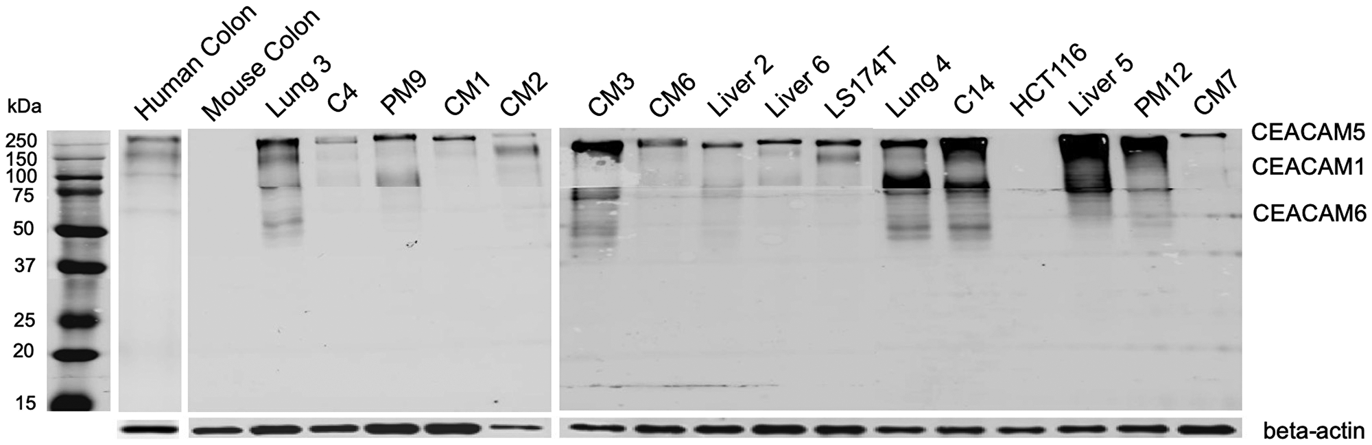 Whole membrane western blot of 6G5j-IR800CW for CEACAM expression in colon cancer lysates.
