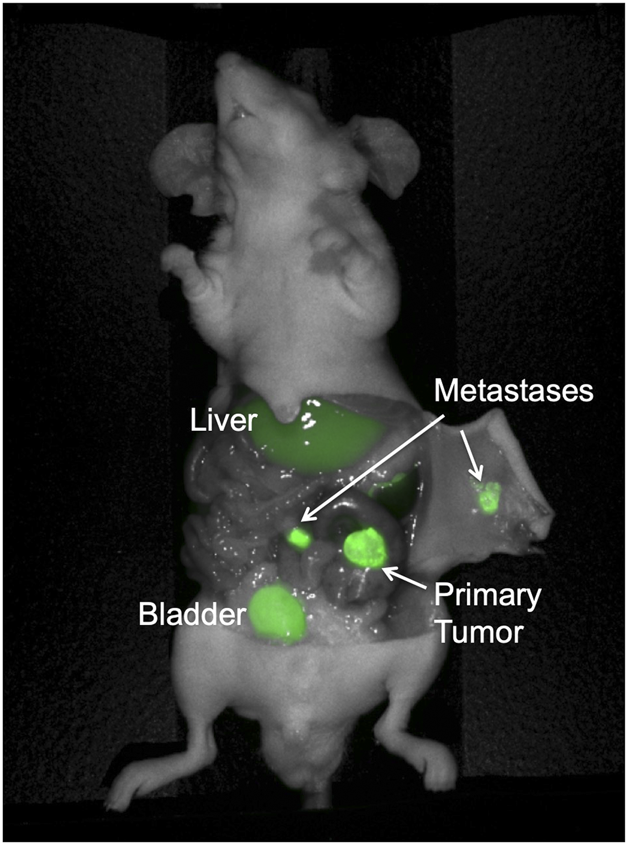Colon cancer PDOX model with regional metastases, implanted on the cecum with patient-derived primary colon tumor sample Lung 4.