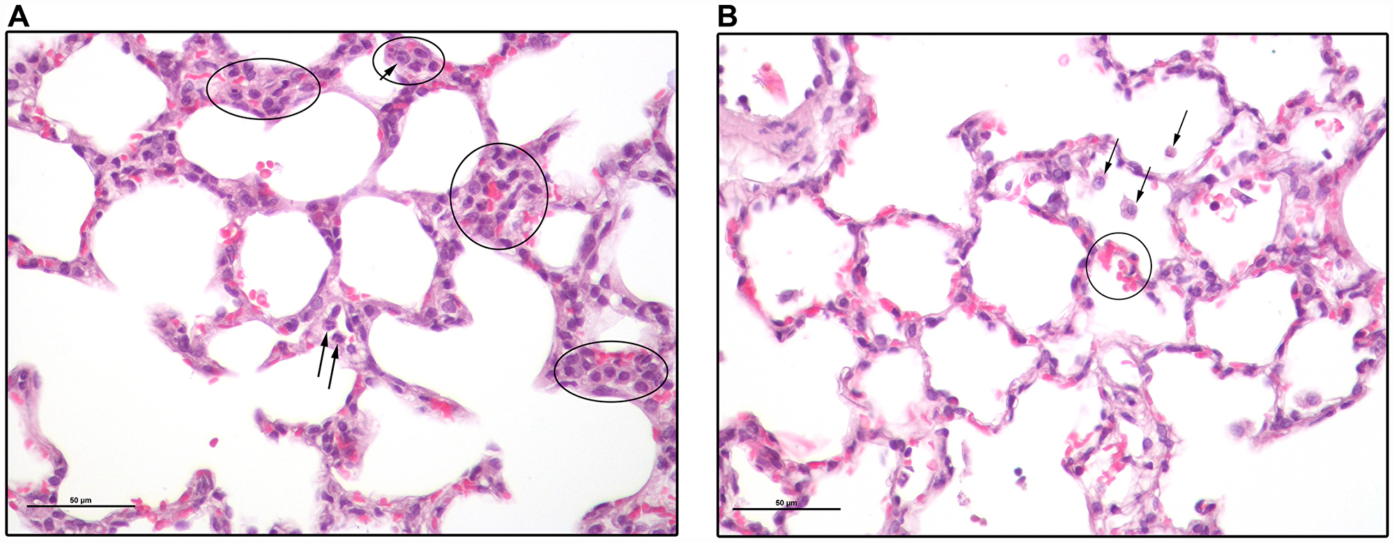 Lung sections of a 2CLP+NCs rat 4 days following the 2CLP-operation.