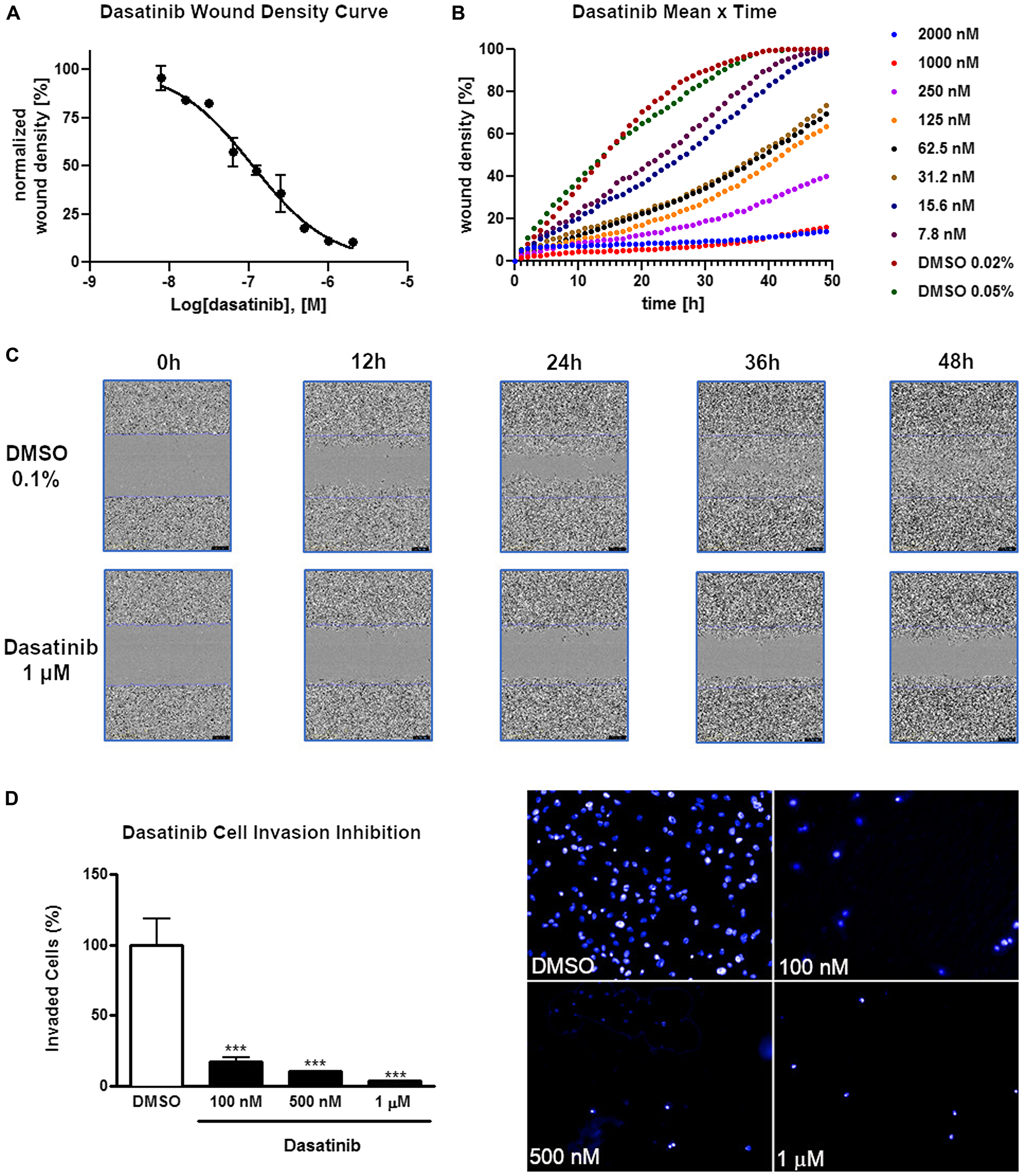 Inhibition of cell invasion and migration of AGP-01 cells by dasatinib.