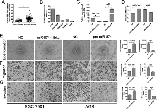 The expression of miR-874 in GC tissues and cell lines. miR-874 negatively regulates HUVEC proliferation, migration, invasion and tube formation in vitro.