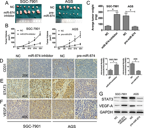 miR-874 inhibits tumorigenicity in vivo.