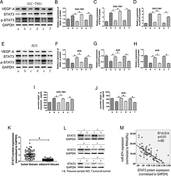 The roles of miR-874 and STAT3 in the regulation of VEGF-A expression in gastric cancer cells.