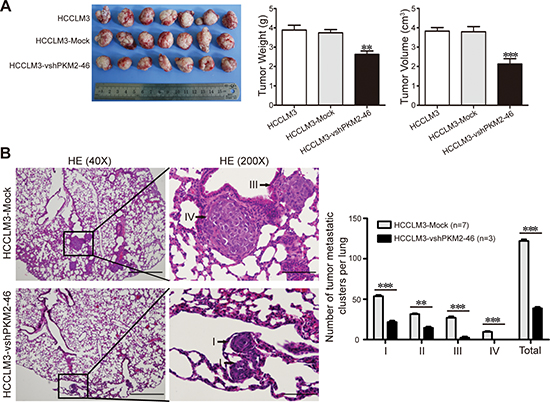 PKM2 promotes HCC progression in a xenograft nude mice model.