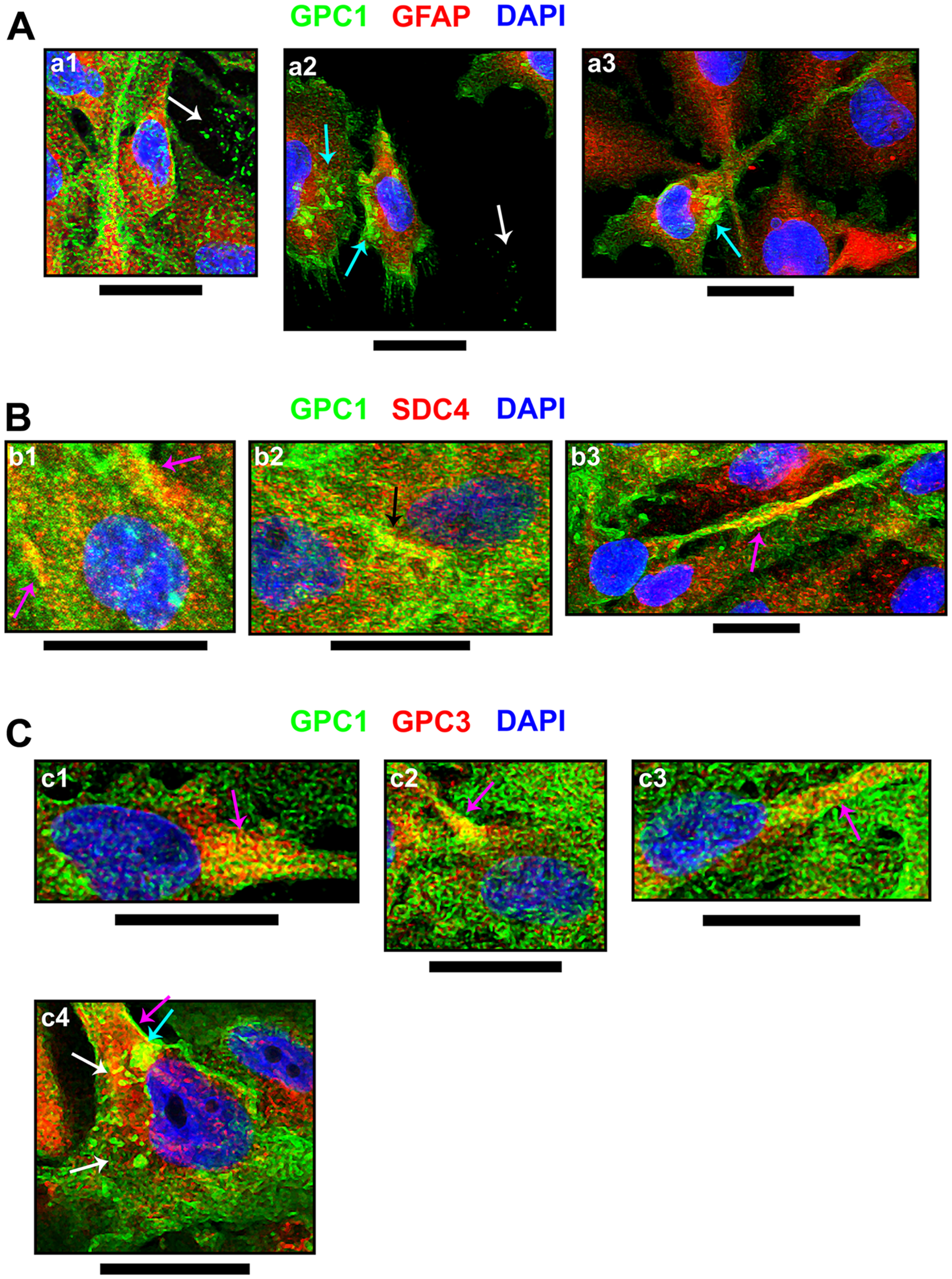 Cellular events indicating GPC1 and its association with SDC4 or GPC3.