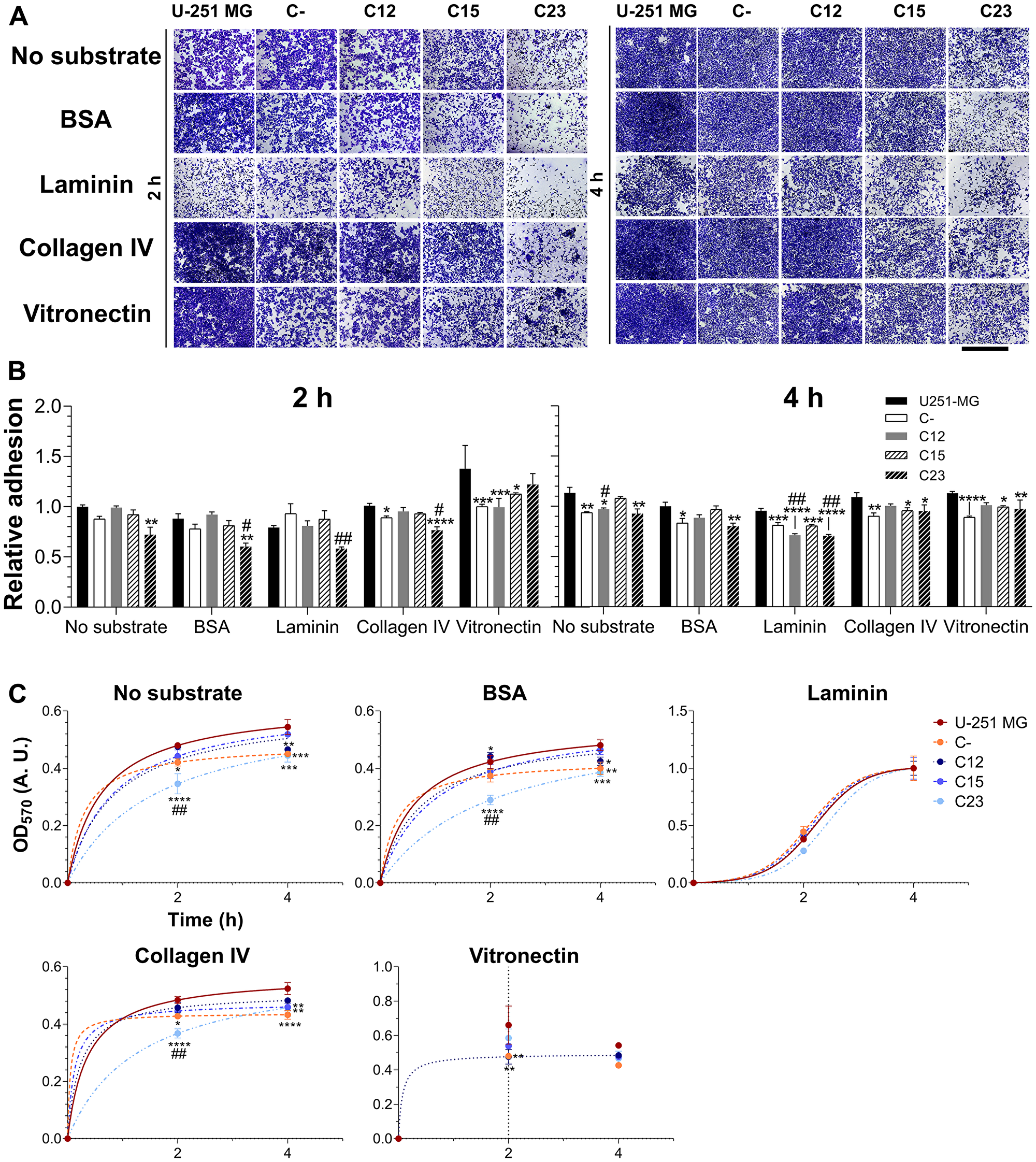 Investigation of GPC1’s role in adhesion of GBM cells.