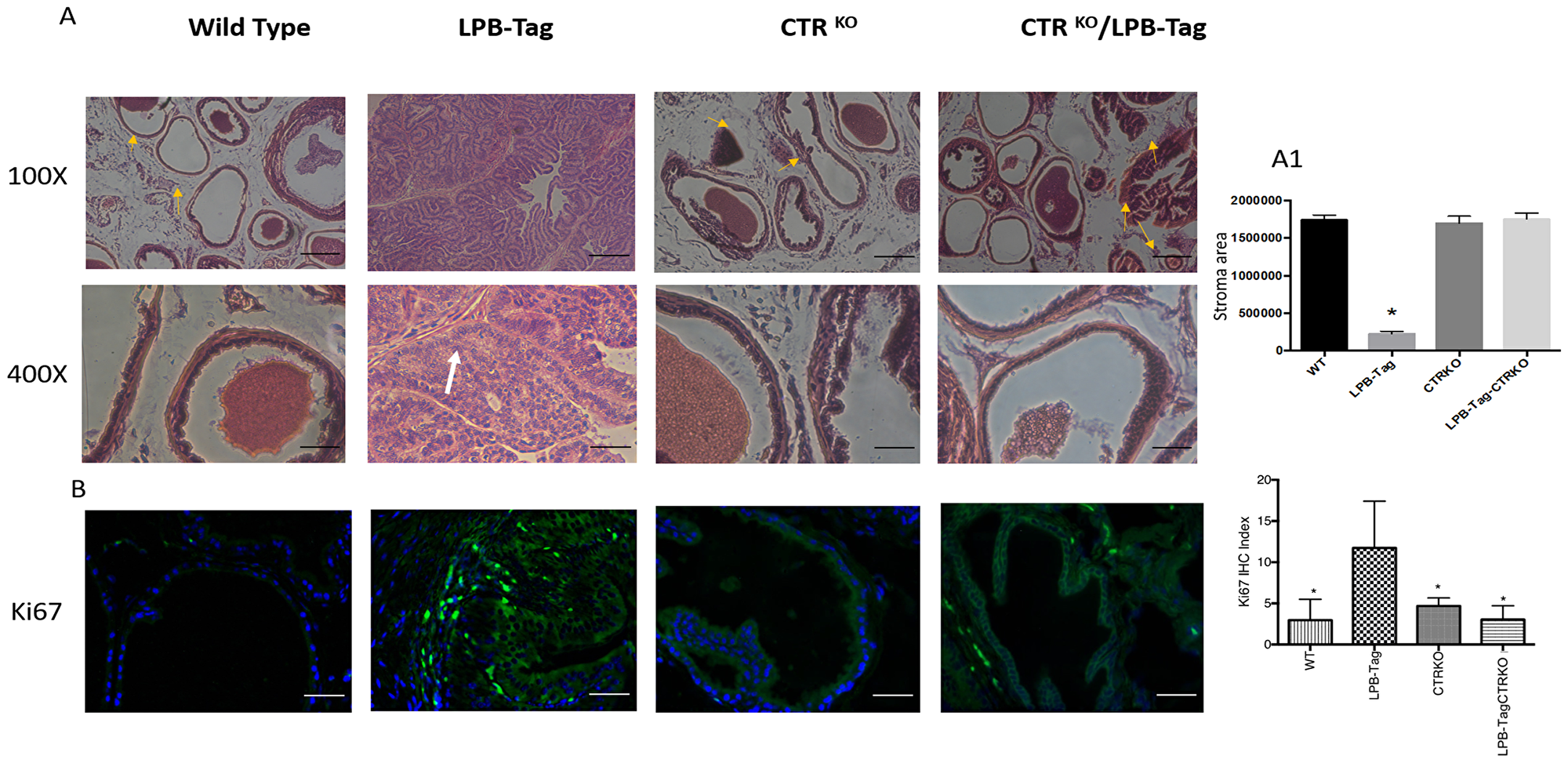 H & E staining of prostate tissue and Ki67 immunoreactivity.