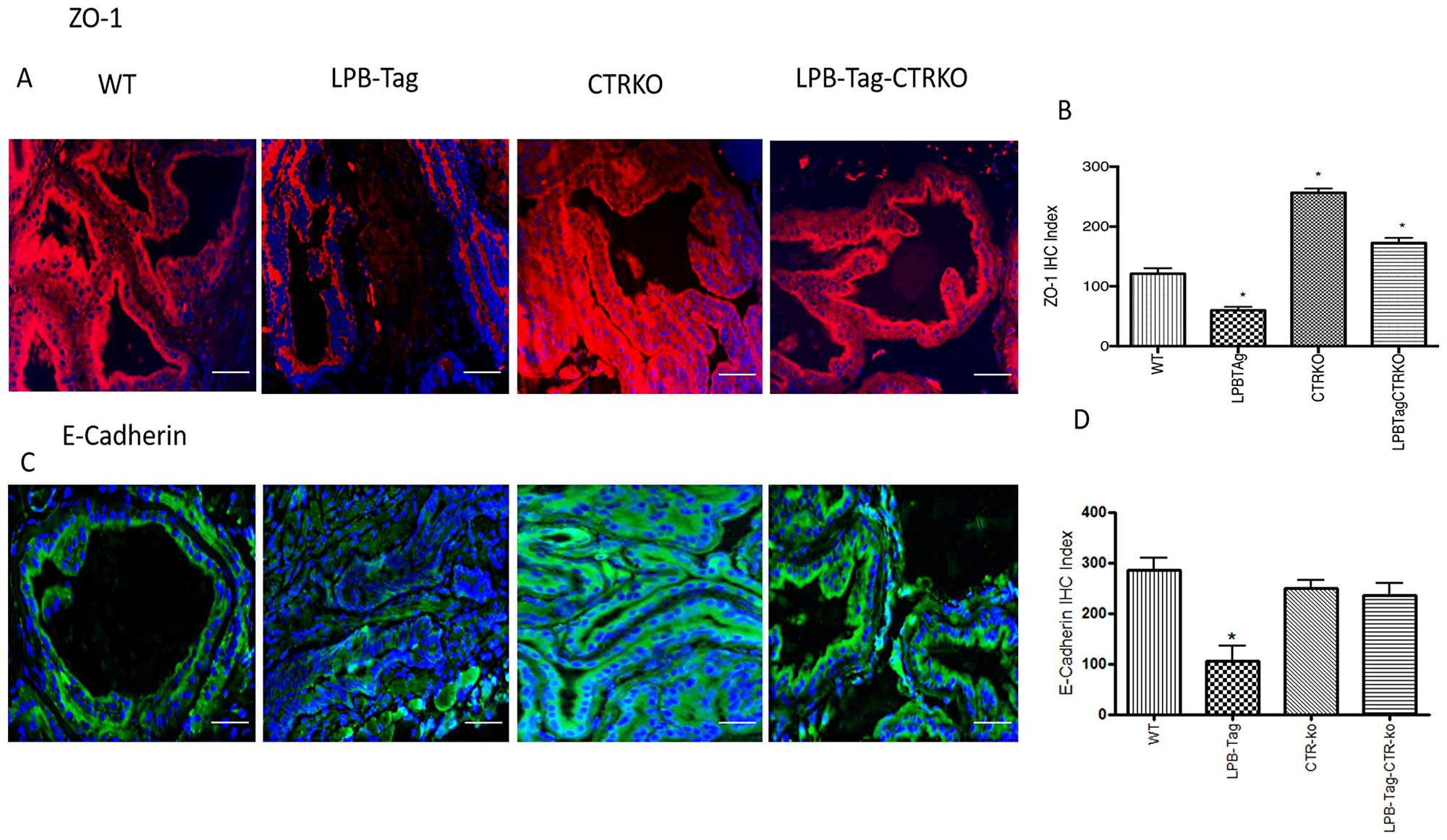 Immunoreactivity of ZO-1 and E-cadherin.