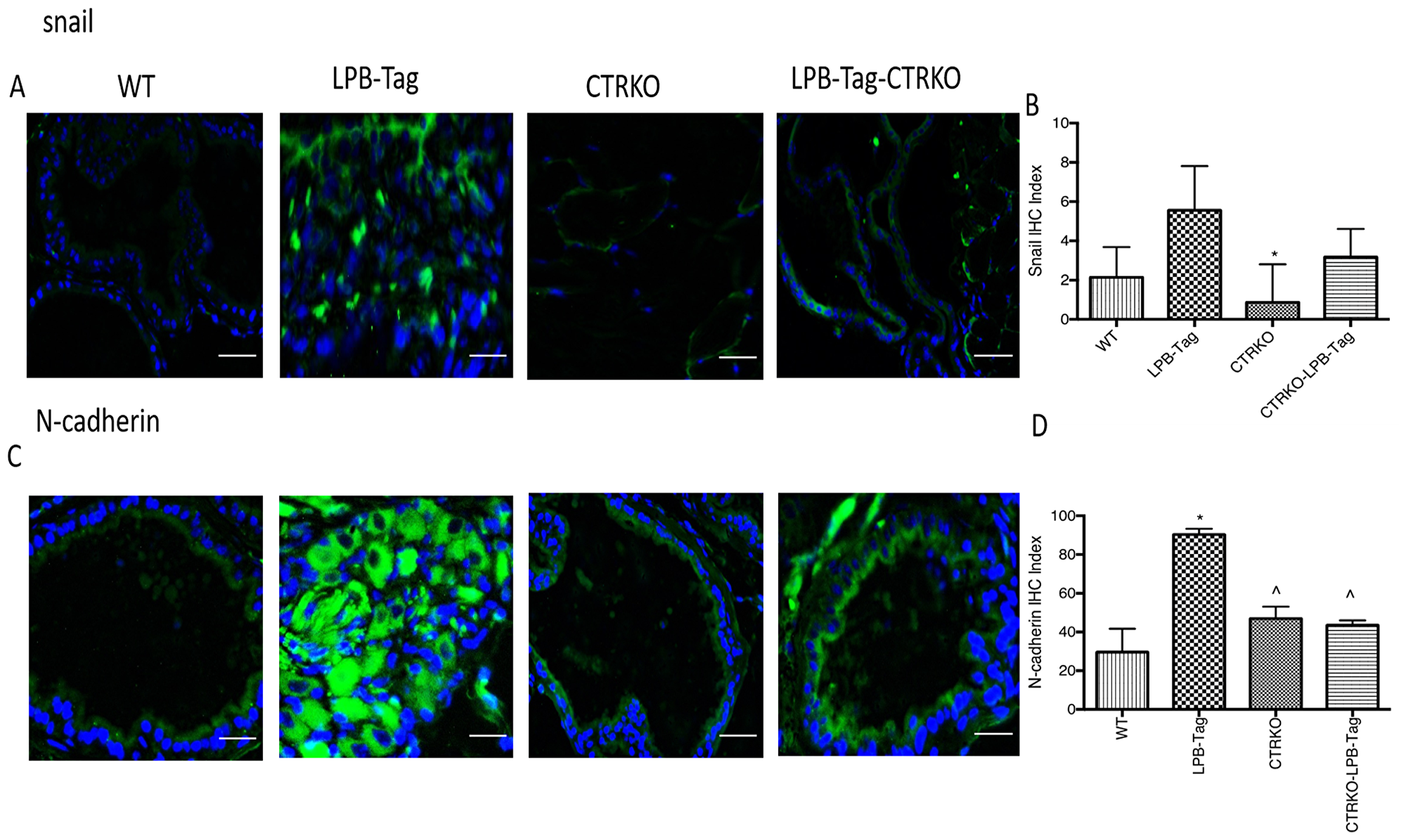 Immunoreactivity of snail and N-cadherin.