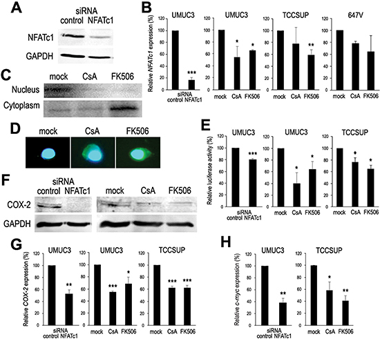 Inactivation of NFATc1 in bladder cancer.