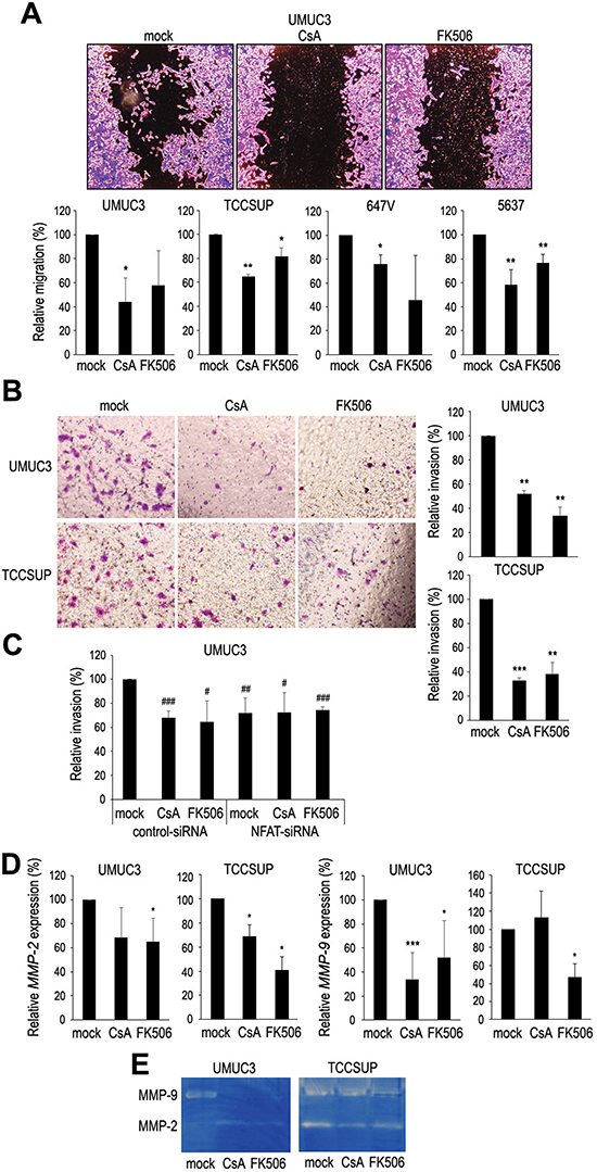 Effects of NFAT inactivation on cell migration and invasion.