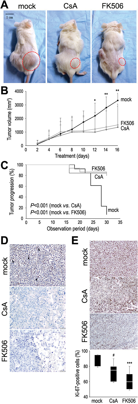 Effects of CsA and FK506 on tumor growth in a mouse xenograft model for bladder cancer.