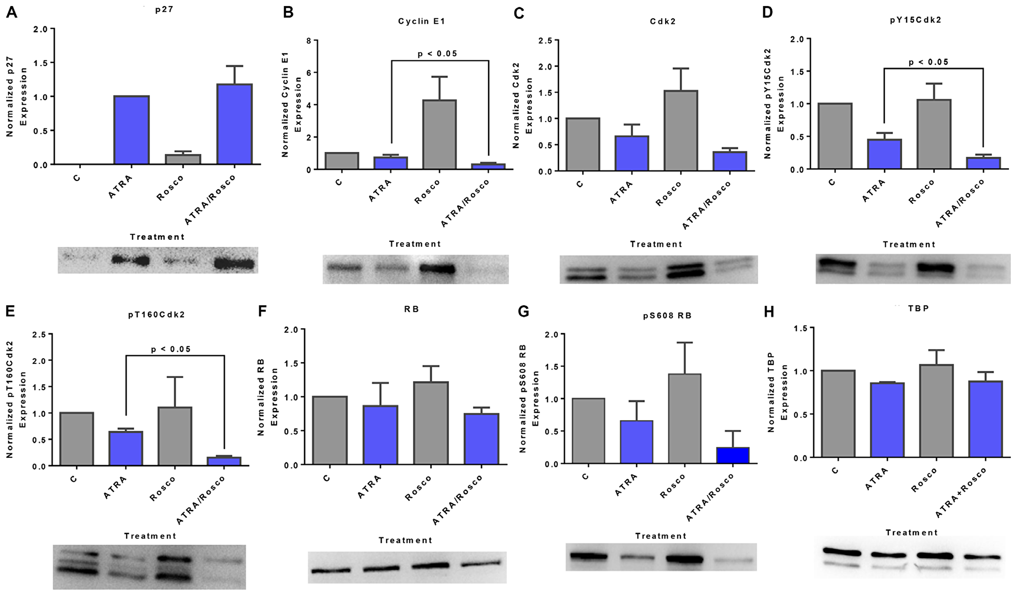 Roscovitine effects on ATRA-induced changes in nuclear expression of G1/G0 regulatory molecules: p27/cyclin E1/Cdk2/RB pathway.