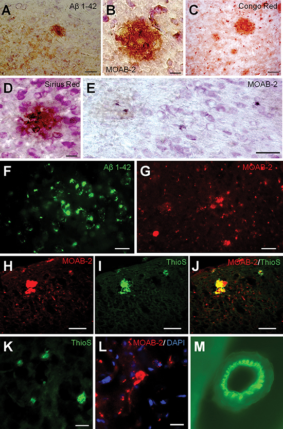 Deposition of Aβ variants in the brain of OXYS rats.