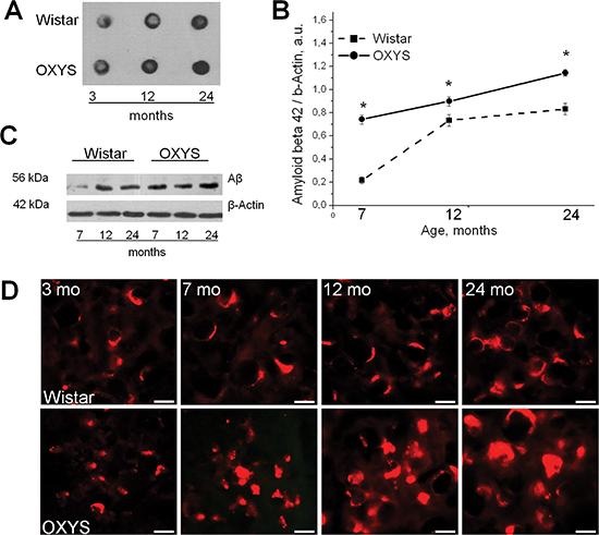 The pronounced accumulation of Aβ1–42 with age in the brain of OXYS rats.