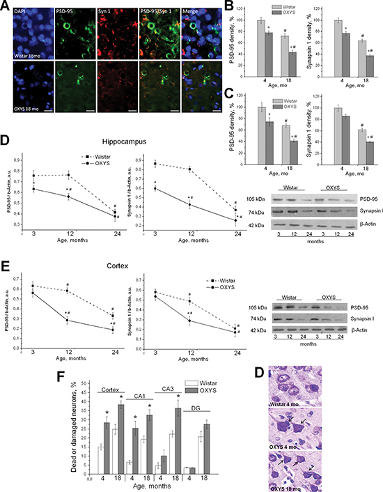 Synaptic losses and progressive neurodegeneration in OXYS rats.