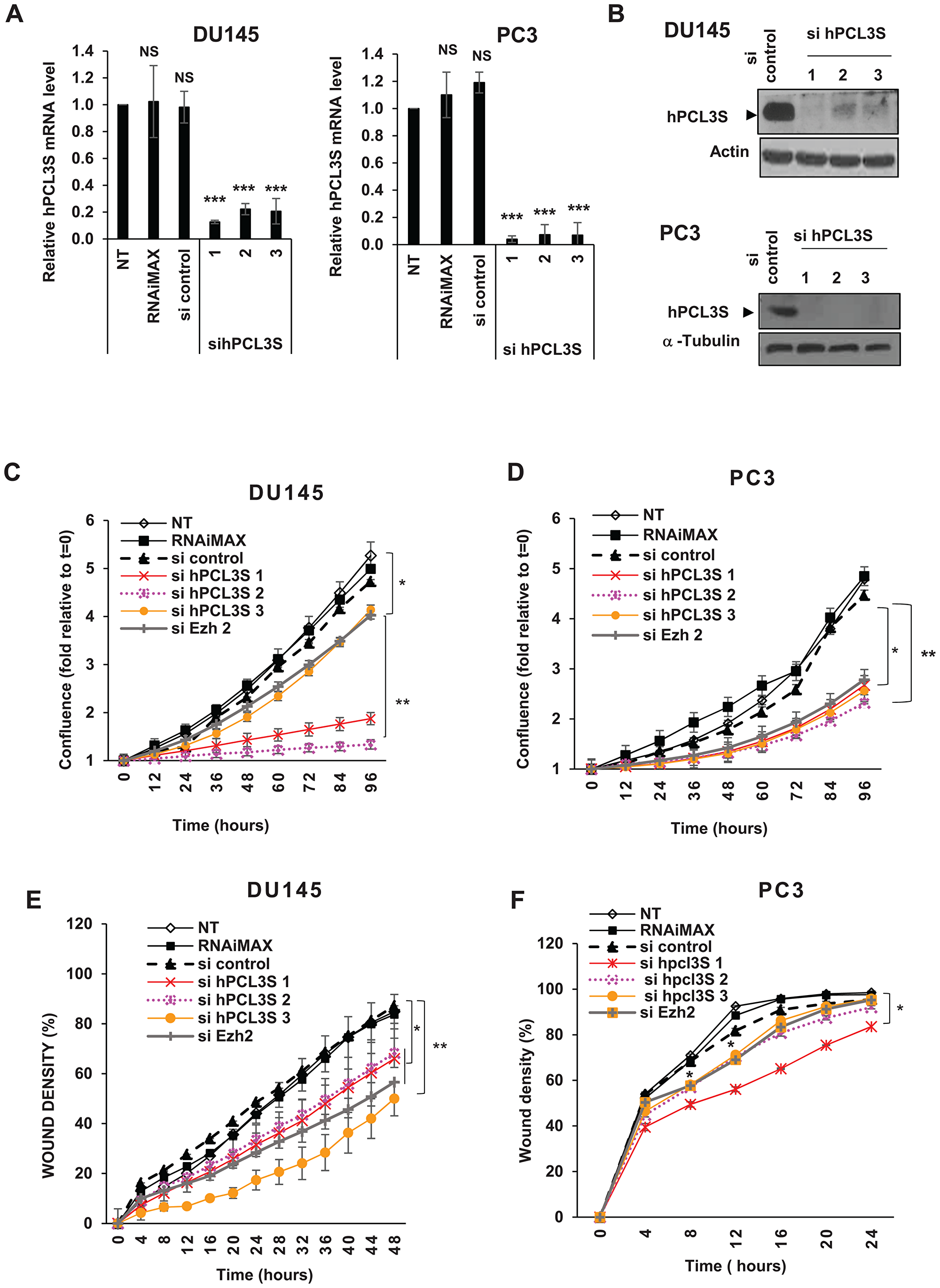 hPCL3S is essential for DU145 and PC3 cell proliferation and migration.