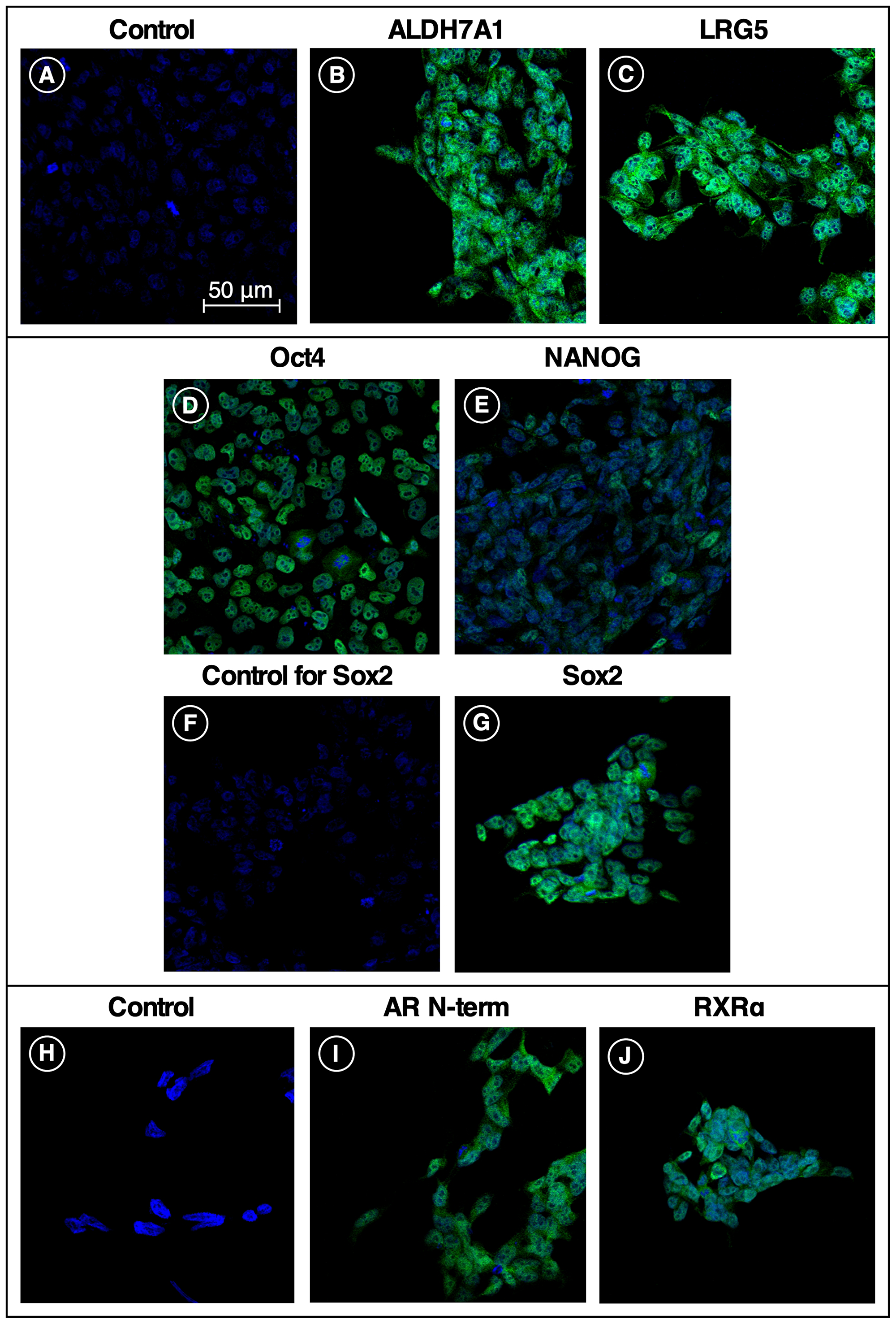 Stem cell and receptor markers expressed in iPS87 cells.