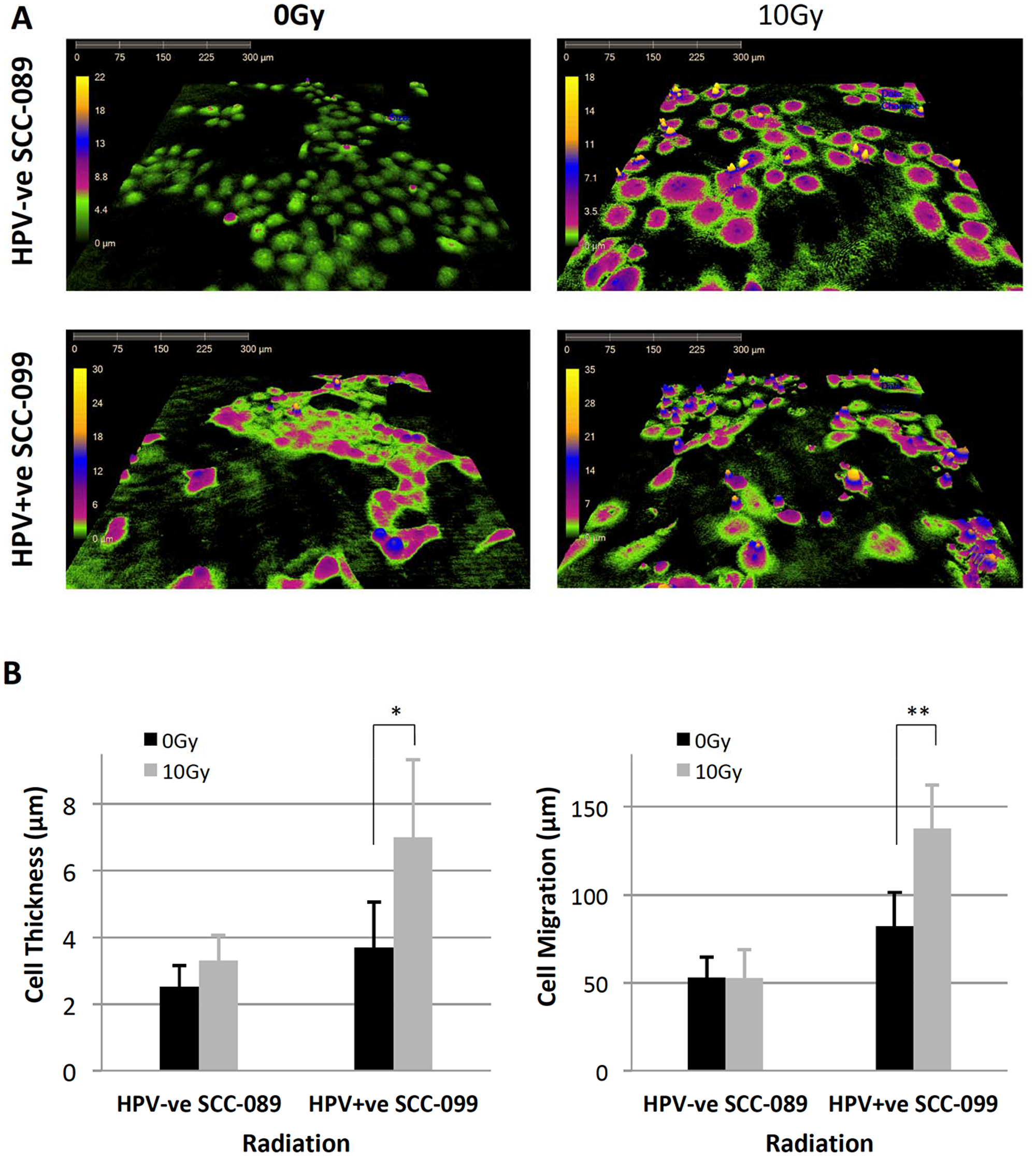 Radiation induced morphological changes on HPV-SCC-089 and HPV+SCC-099 by Holographic microscopy.