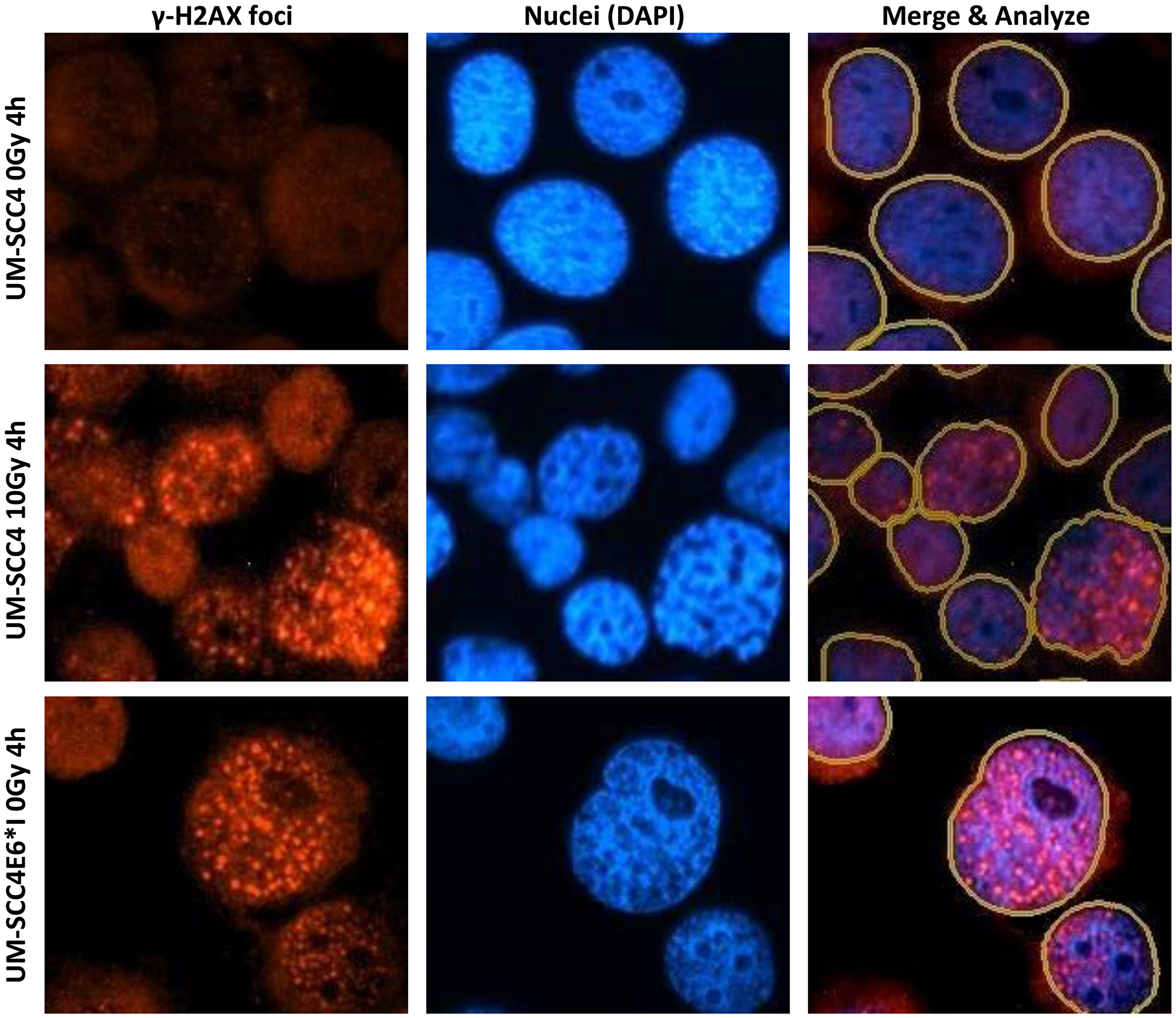 Examples of &gamma;-H2AX foci staining of UM-SCC4 and UM-SCC4 E6*I cells.