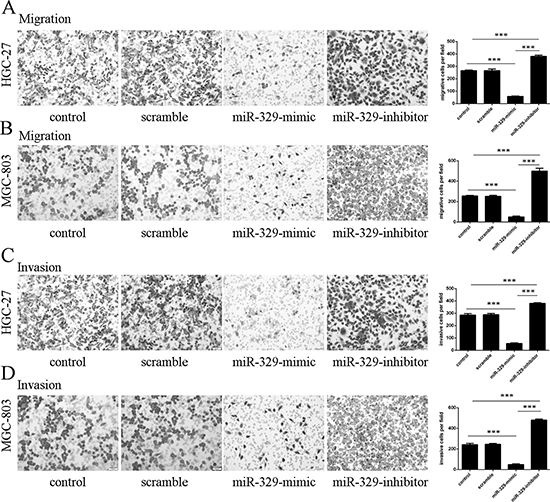 Overexpression of miR-329 inhibited GC cell migration and invasion.