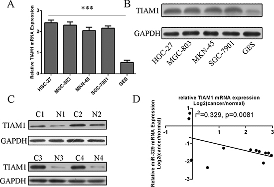 TIAM1 was inversely expressed with miR-329 in GC patients.