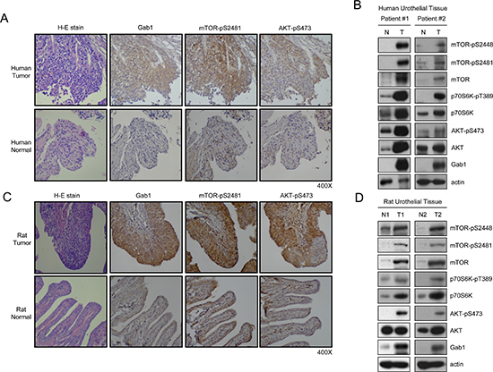 Elevated expression of Gab1 is associated with increased activation of mTORCs in urothelial carcinoma.
