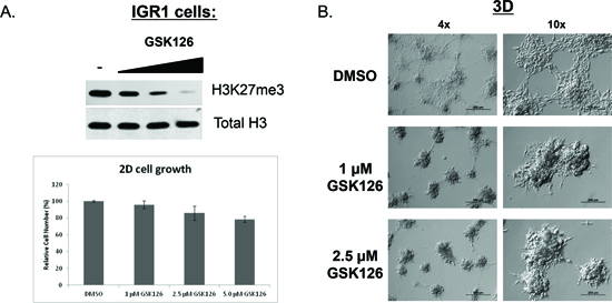 Catalytic inhibition of endogenous EZH2 Y641N (GOF) alters 3D-morphology of IGR1 melanoma cells.