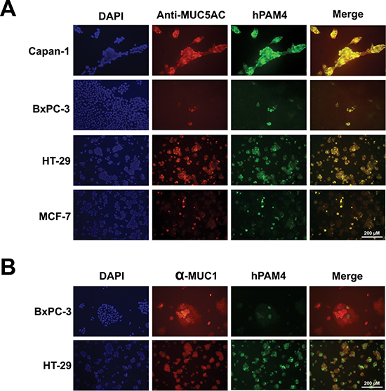 Co-localization of PAM4 antigen with MUC5AC by immunofluorescence staining.