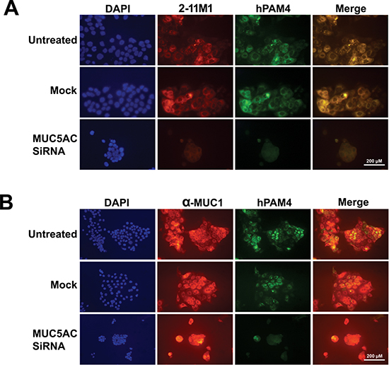 Co-knockdown of PAM4 antigen and MUC5AC by MUC5AC-specific siRNA.