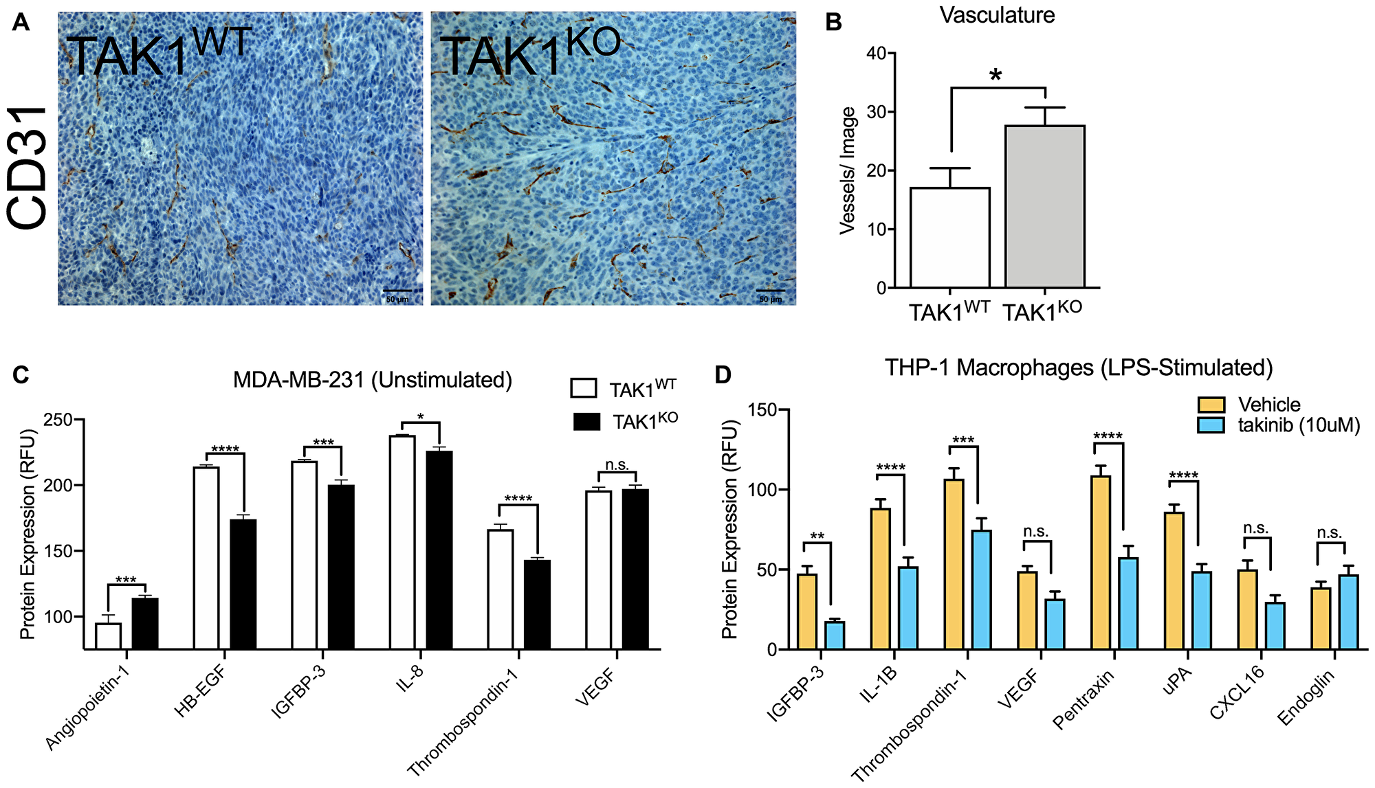The role of TAK1 in cancer cell and macrophage vasculature.
