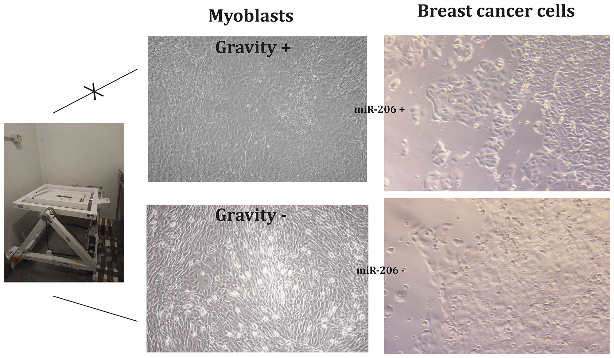 Figure 4: Myoblasts stimulated by gravity (G) release miRNA-microvesicles inhibiting breast cancer cell growth.