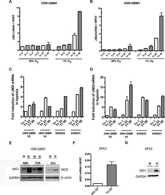 Hypoxia induces Notch ligand expression in malignant tumors.