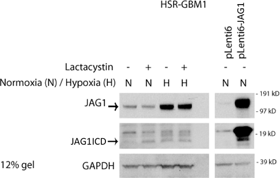 Hypoxia and JAG1 overexpression increases ligand ICD production.