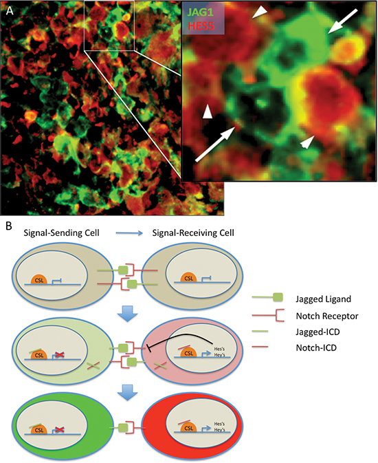 Modeling Notch signaling in GBM.