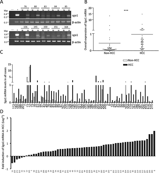 Messenger RNA expression profile of Sgo1 in HCC and adjacent non-HCC tissues.