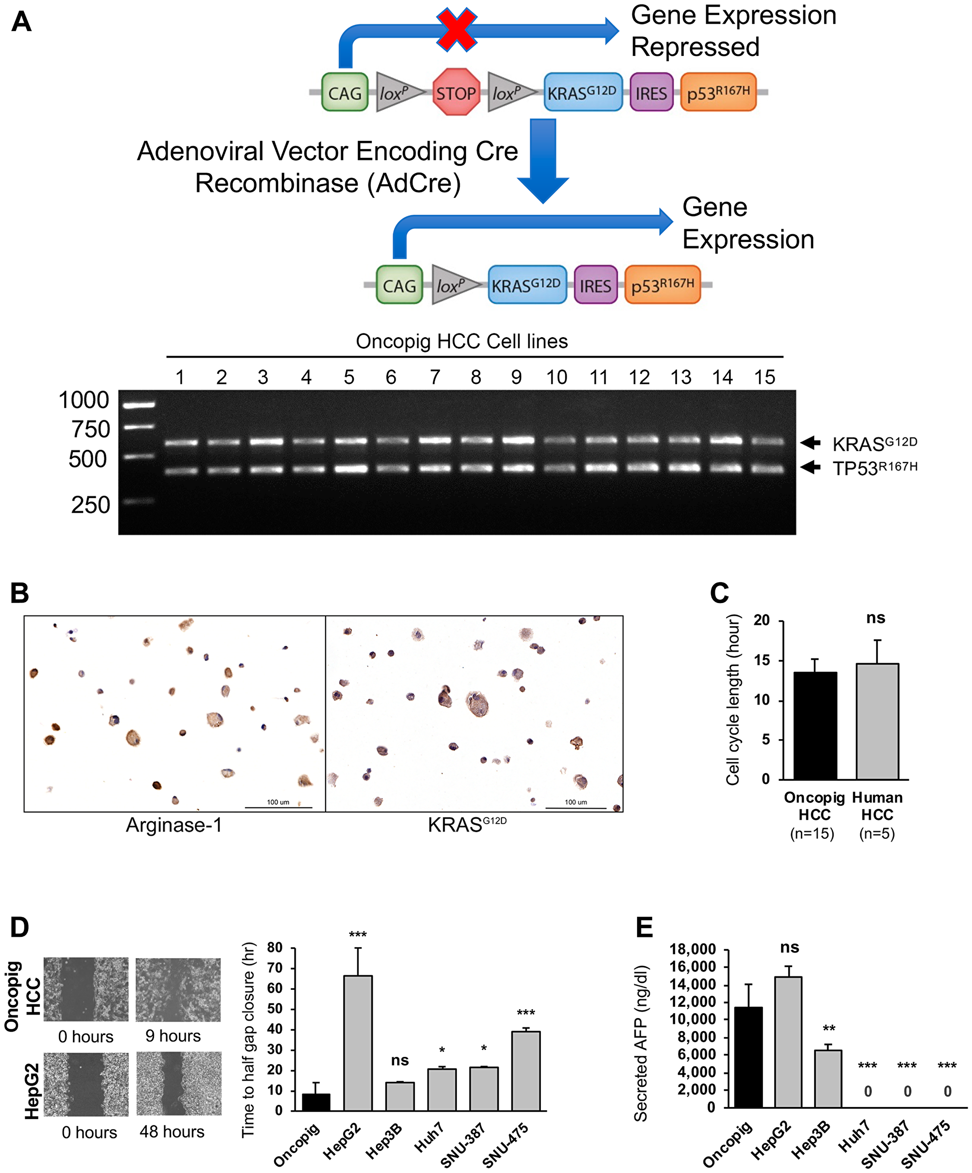 Oncopig and human HCC in vitro phenotypes.