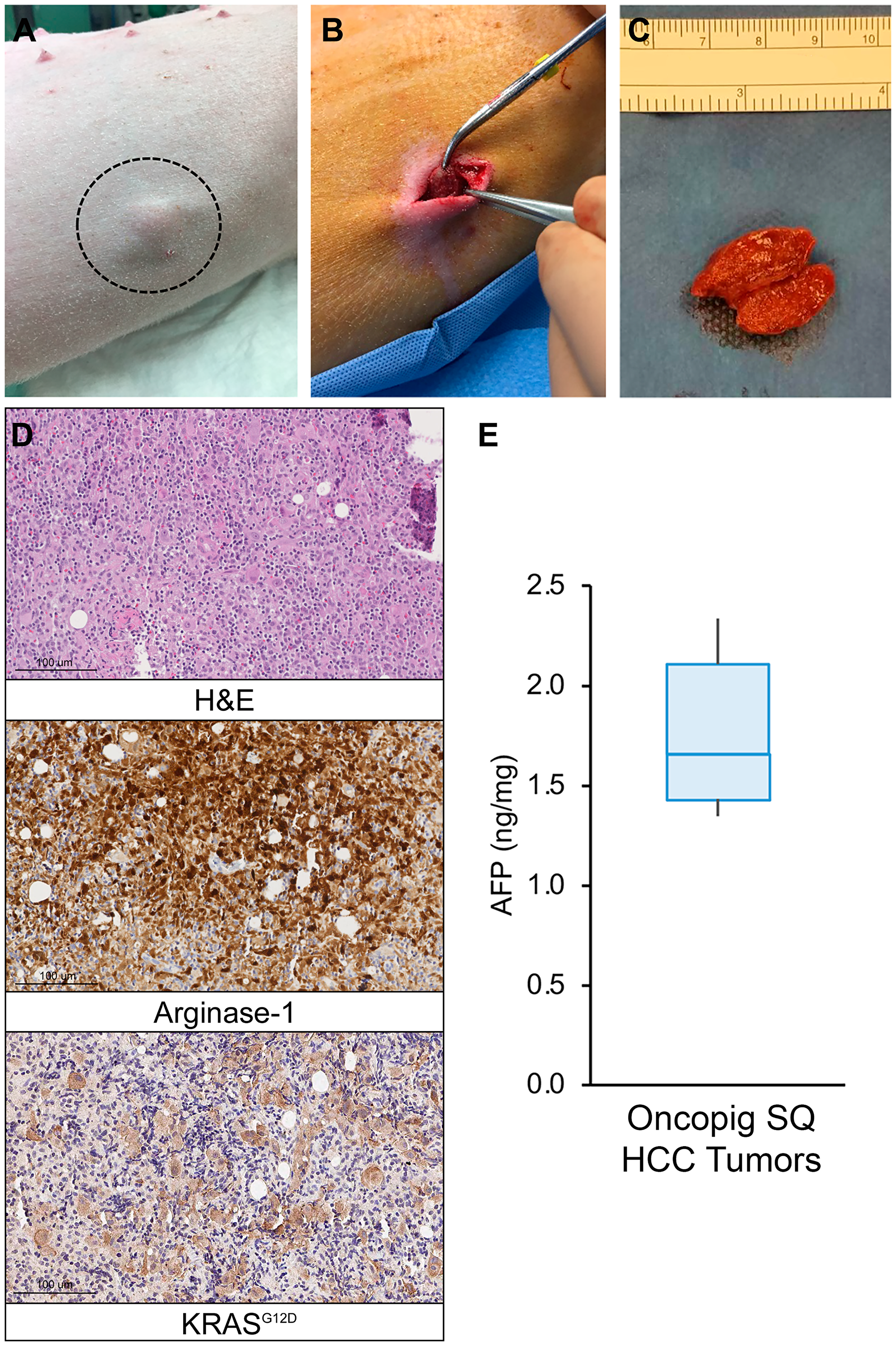 Oncopig SQ HCC autograft formation.