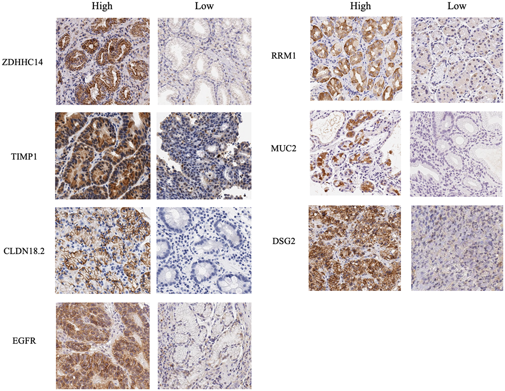 Immunohistochemical images for proteins encoded by seven biomarker candidate genes.