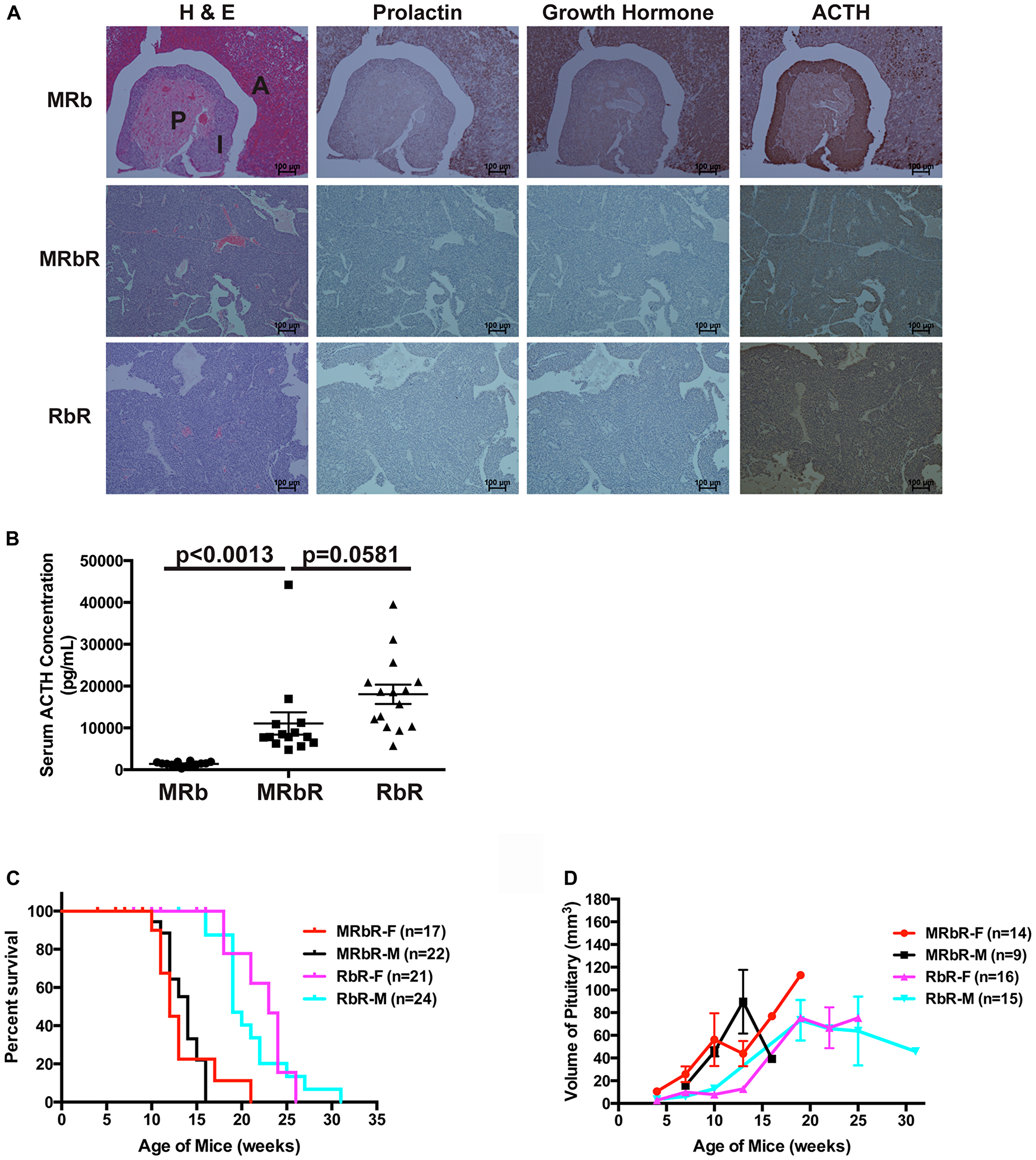 MRbR mice developed ACTH-secreting PitNETs.